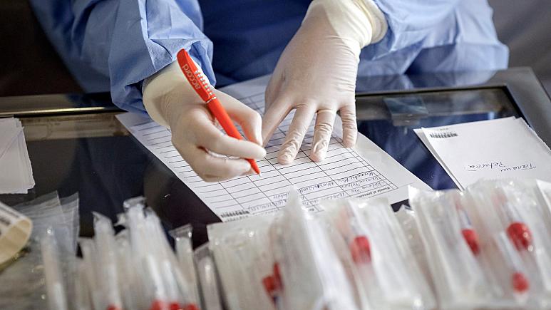 Hangi ülkede kaç kişiye koronavirüs testi yapıldı?