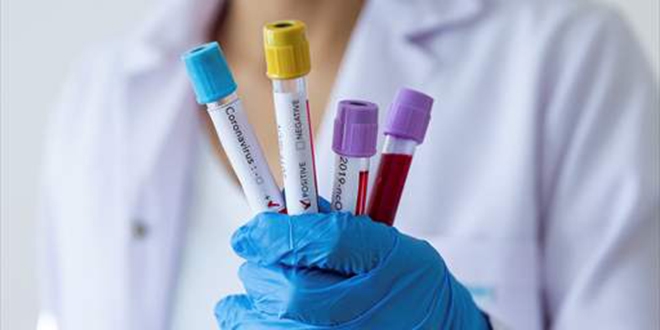 Güney Kıbrıs’da 16 Yeni vaka ve 1  ölüm daha