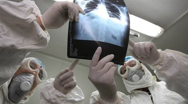 Koronavirüs belirtilerine altı yeni semptom daha ekledi