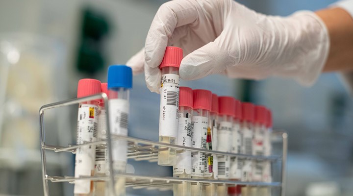 Güney’de bin 287 test, 1 pozitif vaka