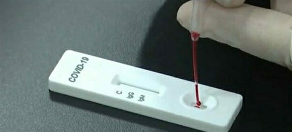 Toplam 1389 test yapıldı, 6 pozitif vakaya rastlandı
