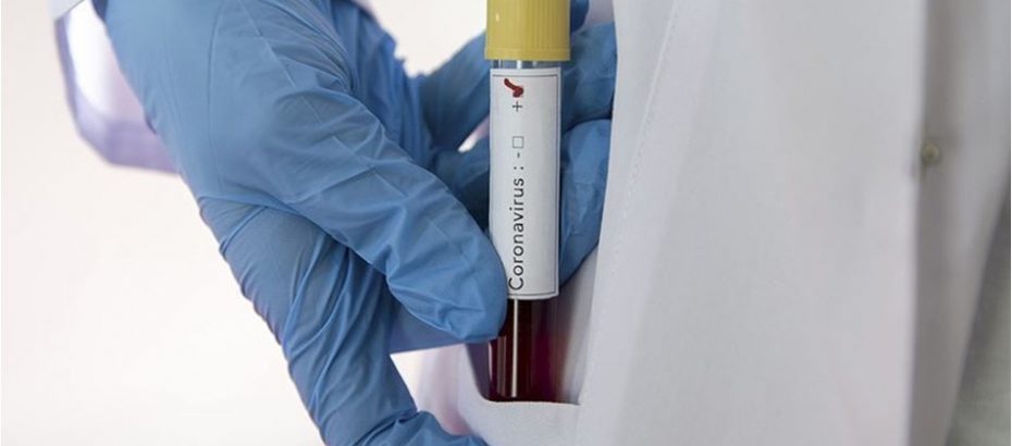 Güney Kıbrıs’ta 11 yeni vaka!