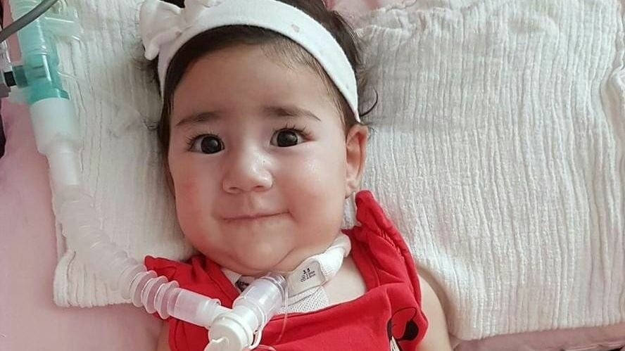 Asya bebeğin tedavisine başlandı
