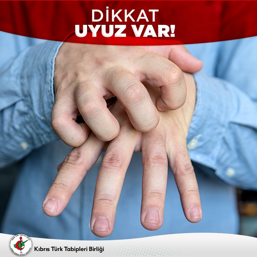 Dikkat uyuz var!
