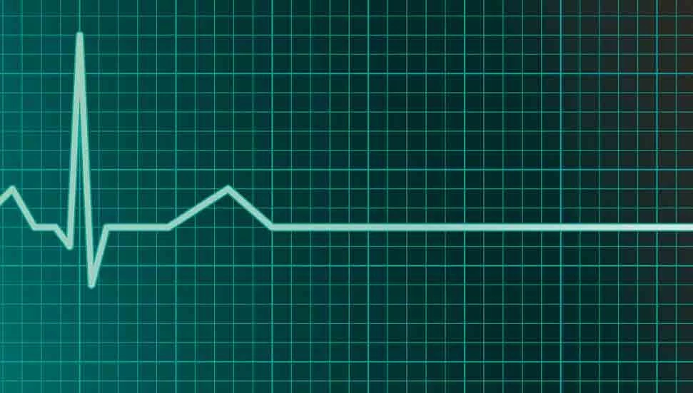 81 yaşındaki Brassington hayatını kaybetti