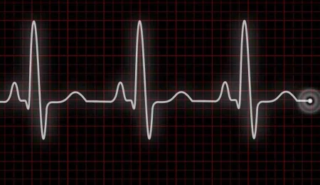 Lefkoşa’da iki ölüm: Ayşe Cüferler ve Güner Günal yaşamını yitirdi!