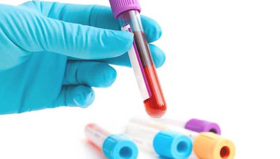 Ercan Havalimanı ve Taşyapı İnşaat’ta kan bağış kampanyası düzenlenecek