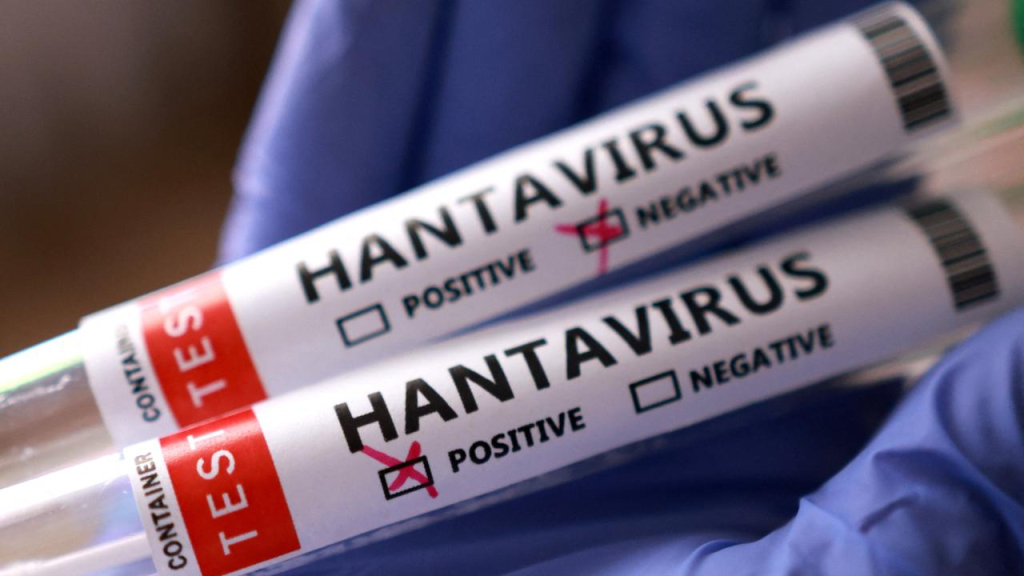 “Türkiye’de henüz hantavirüs vakası tespit edilmedi”