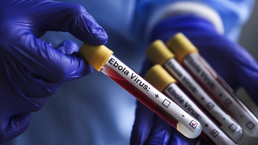 Rum makamlar Ebola’ya karşı uyarı durumunda