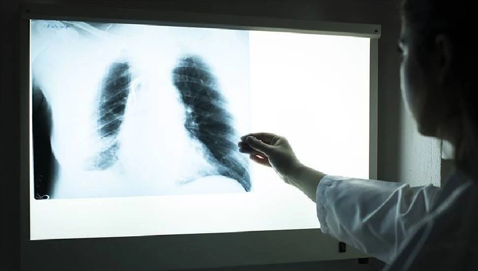 Uzmanlar ciğerlere iyi gelen vitaminleri açıkladı